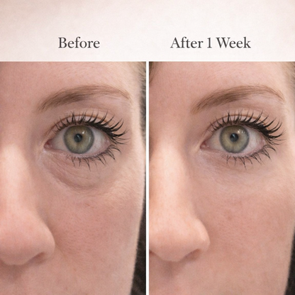 Revivaeyes® Eye Cream